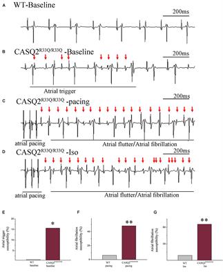 Calcium-Mediated Oscillation in Membrane Potentials and Atrial-Triggered Activity in Atrial Cells of Casq2R33Q/R33Q Mutation Mice